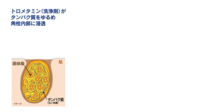 トロメタミン（洗浄剤）がタンパク質をゆるめ角栓内部に浸透 → 固体の脂を水に溶けやすい状態に変化させる → すすぐと角栓内部に水が入り込み角栓が自ら崩壊！